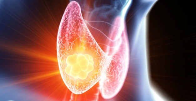 Lenvatinib API: A Potential Treatment for Thyroid Cancer - Qingmu
