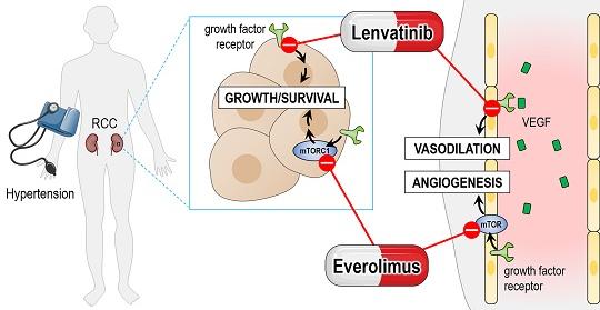 Hypertension Caused by Lenvatinib