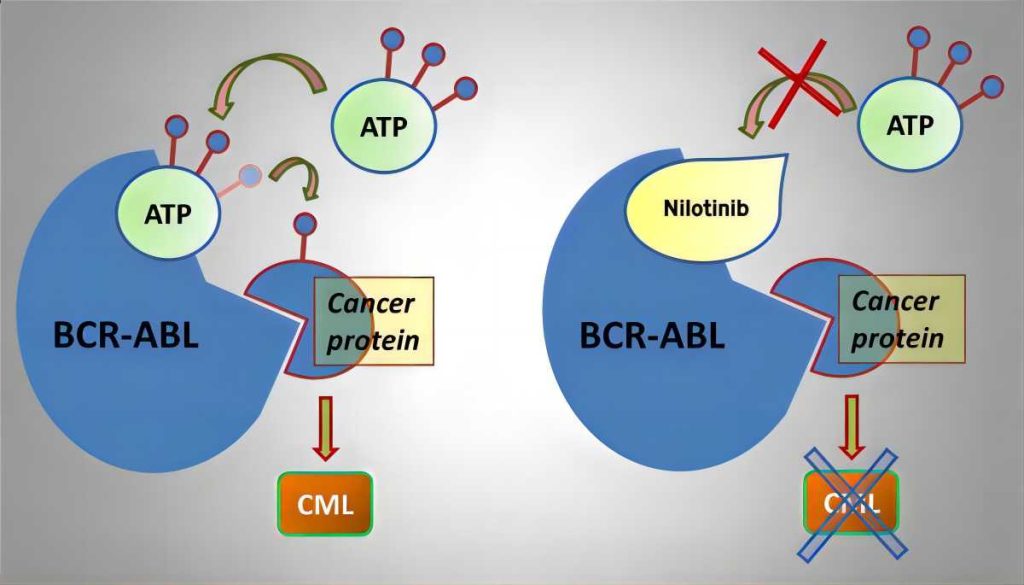 Targeted Therapy for Chronic Myelogenous Leukemia