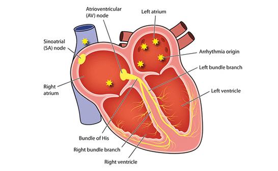 Bisoprolol API for Atrial Fibrillation